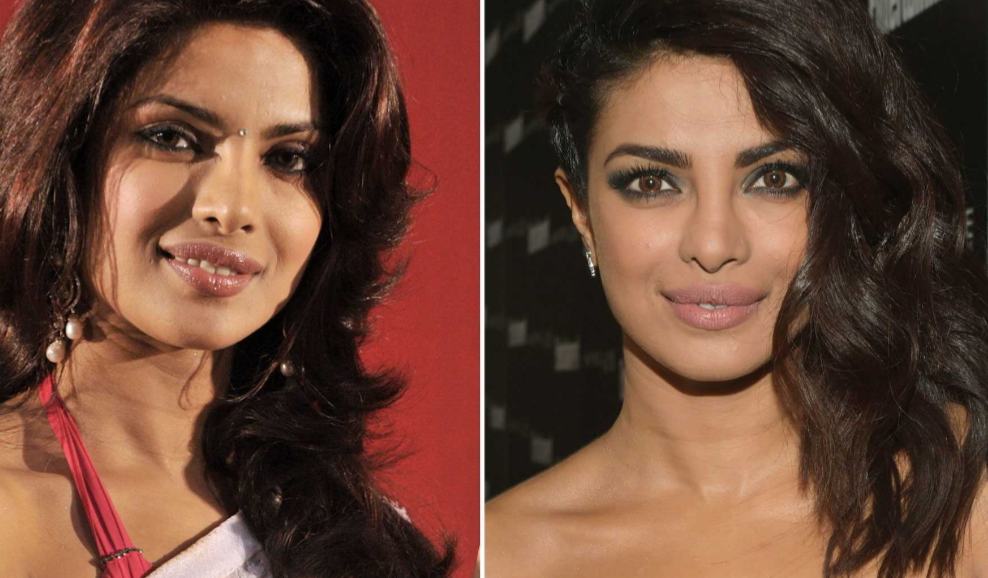 Priyanka Chopra's Before And After Looks: