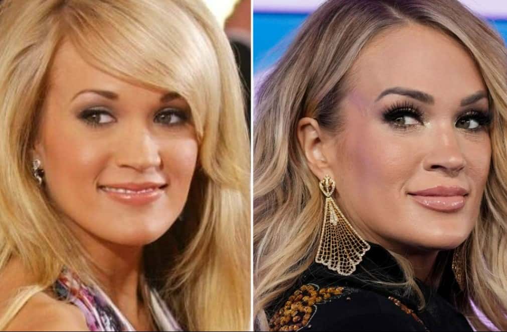 Carrie Underwood Before and After