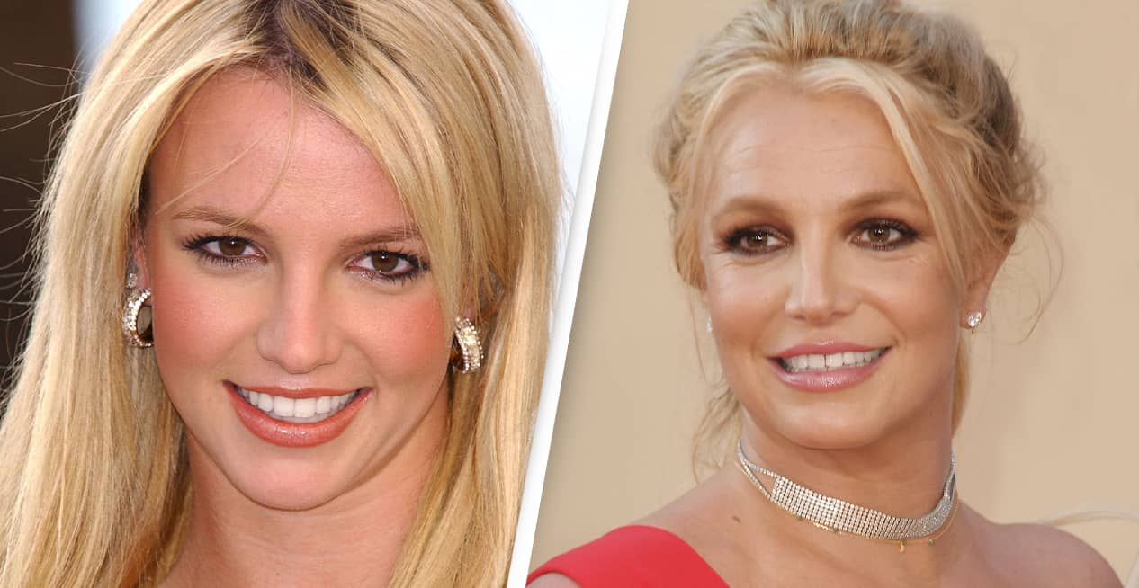 Britney's teeth before vs now.
