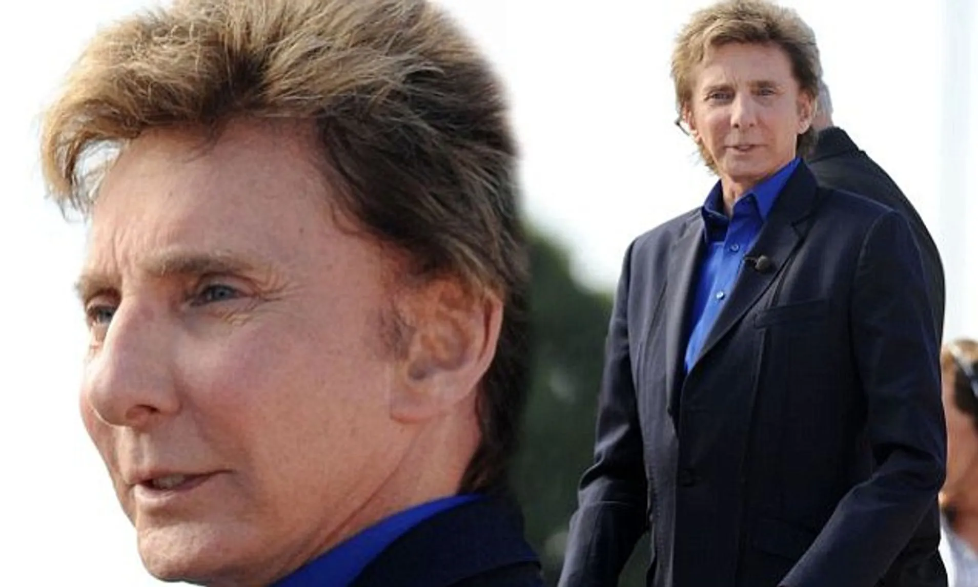 Barry Manilow Before and After